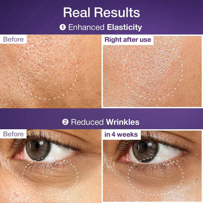 No.9 NAD Bio Lifting-sil Essence - Kbeauty Dropzone