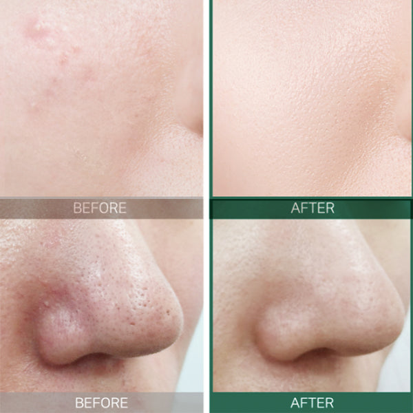 AHA BHA PHA 30 Days Miracle Toner - Kbeauty Dropzone