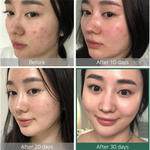 AHA BHA PHA 30 Days Miracle Toner - Kbeauty Dropzone