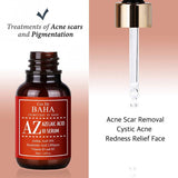 Azelaic Acid 10% Serum