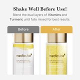 Kojic Acid Turmeric Vita Jelly Mist Serum