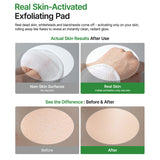 Peel Shot Exfoliating Pad