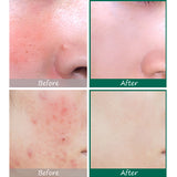 AHA BHA PHA 30 Days Miracle Serum