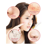 AHA BHA PHA 30 Days Miracle Cleansing Bar