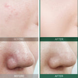 AHA BHA PHA 30 Days Miracle Toner