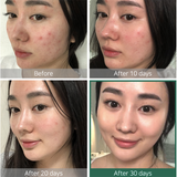 AHA BHA PHA 30 Days Miracle Toner